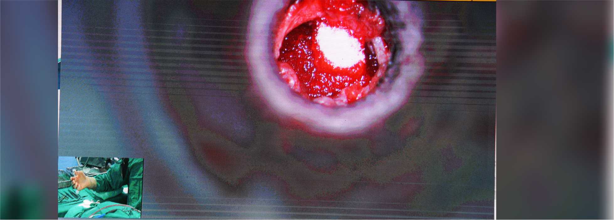 galimgs/ENT CONCLAVE 2022 - International Live Surgical Conference/P - 3.jpg